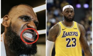 Lakers star LeBron James appears to get his logo implanted on a tooth. (Credit: Twitter/@Lakers and Getty Images)